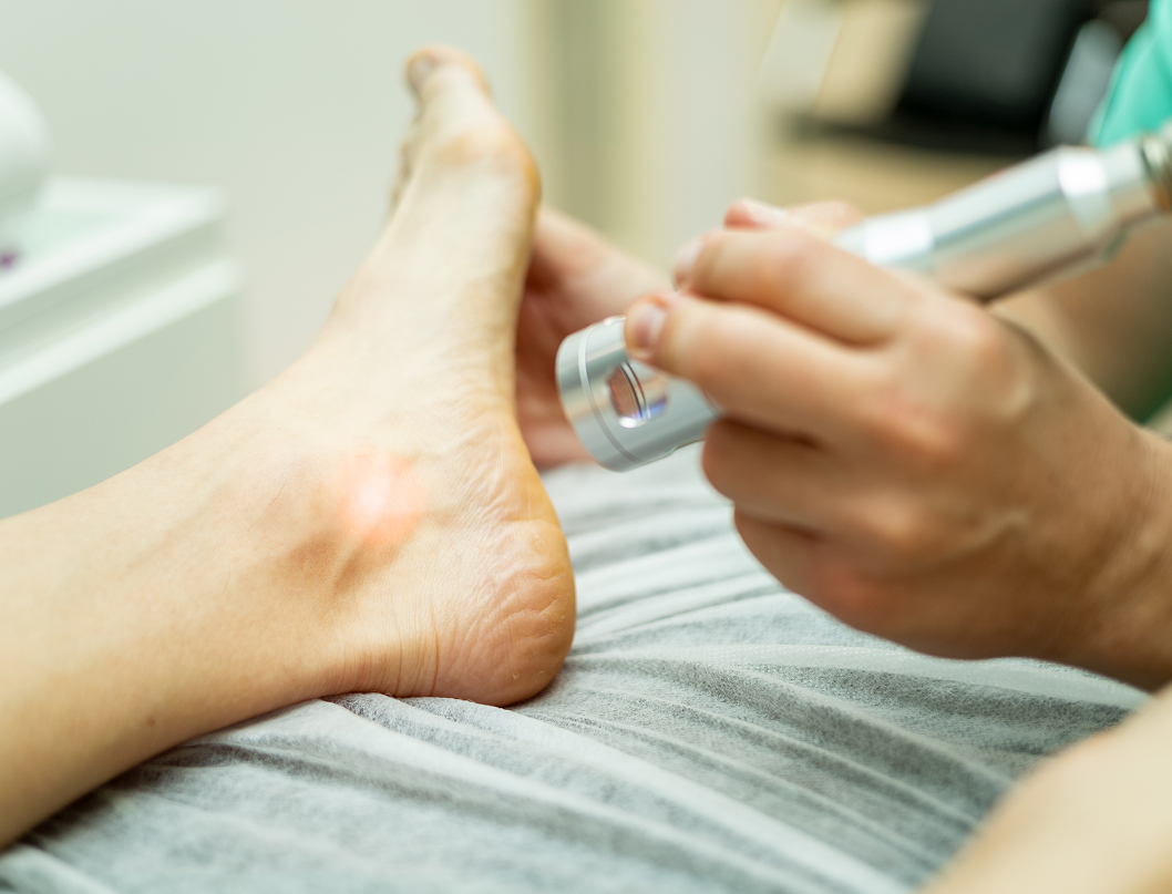 Doucet Sabrina Fabrication Attelle Sur Mesure Bordeaux Therapie Laser